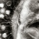 “Normal”-sized phages infecting a bacterial cell.